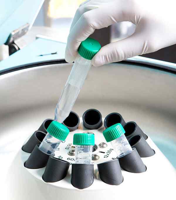 Histopatology tests